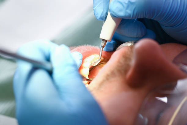 Best Walk-In Emergency Dentist in Santa Maria, CA