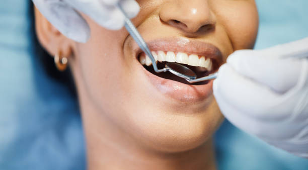 Best Emergency Dental Care for Trauma or Injury in Santa Maria, CA
