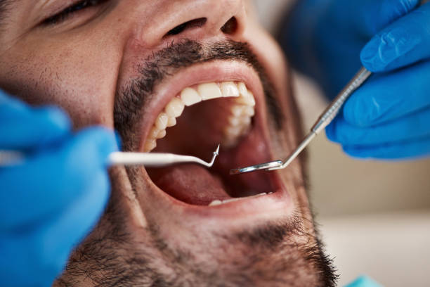 Best Weekend Emergency Dentist in Santa Maria, CA